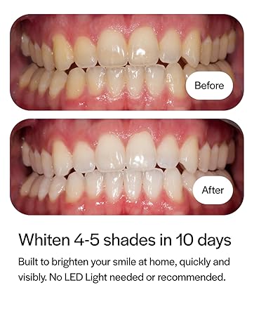 Opalescence Go 15% Prefilled Teeth Whitening Trays